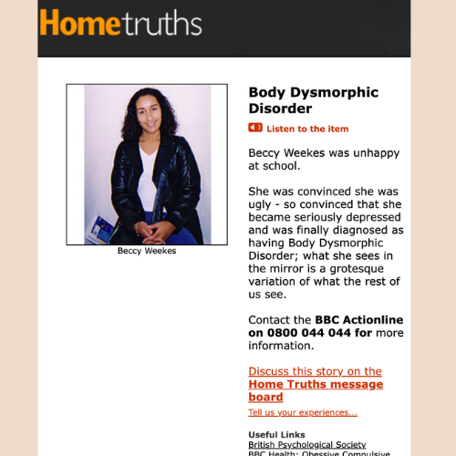 Body dysmorphia